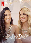 Skin Decision: Before and After S01E01