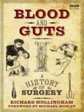 Blood and Guts: A History of Surgery S01E03